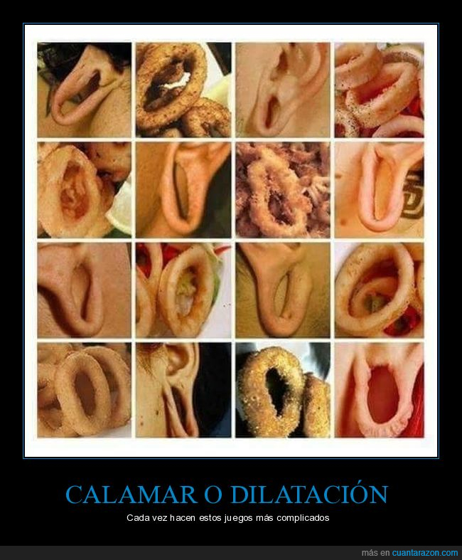 oreja,calamar,dilatación